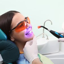 Is Dental Bonding Strong Enough to Make Teeth Bond Stronger?