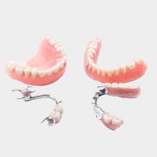 Why Are Partial Dentures Considered As Tooth Replacement Solutions?