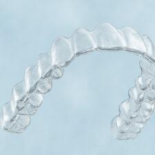 Clear Aligners 101: Why Clearwater, FL Is the Place for a Confident Smile